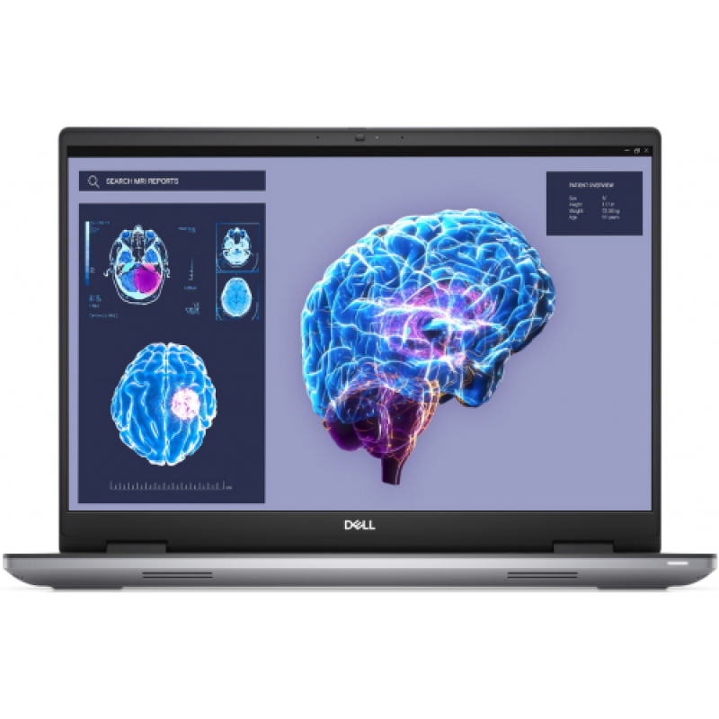 Laptop Workstation Dell Precision 7680, cu procesor Intel Core i9-13950HX, 16'' IPS, 128 GB DDR5, 256 GB, NVIDIA RTX 5000, 16GB GDDR6, Windows 11 Pro, 5 ani Garantie (DP7680154235733_P)